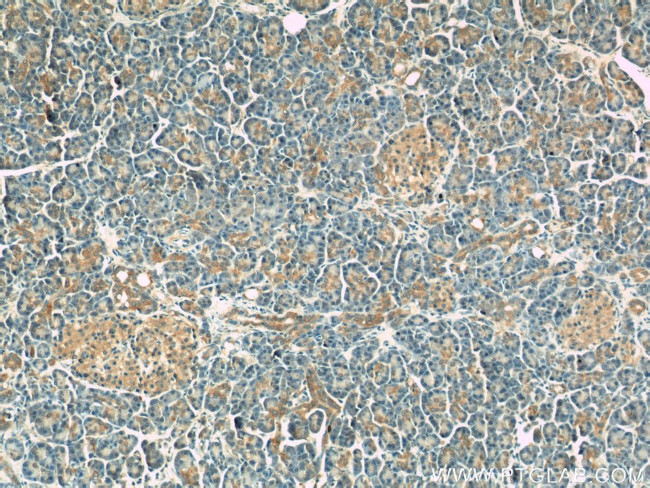 DYNLT1 Antibody in Immunohistochemistry (Paraffin) (IHC (P))