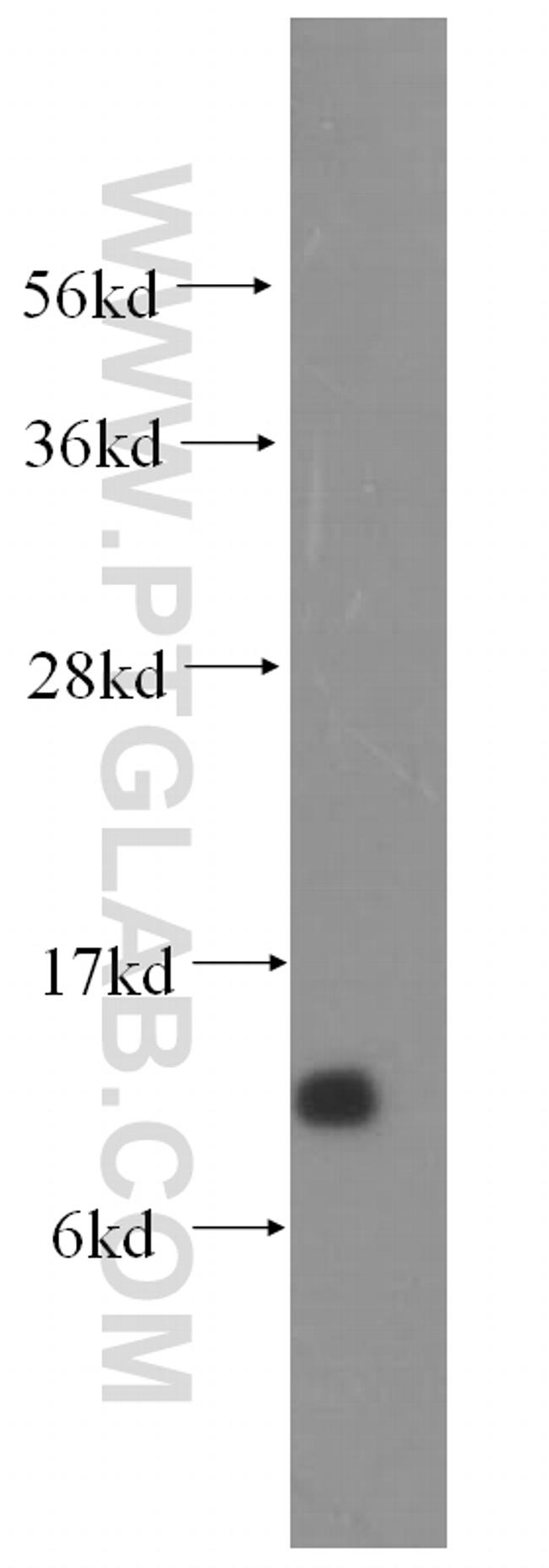 DYNLT1 Antibody in Western Blot (WB)