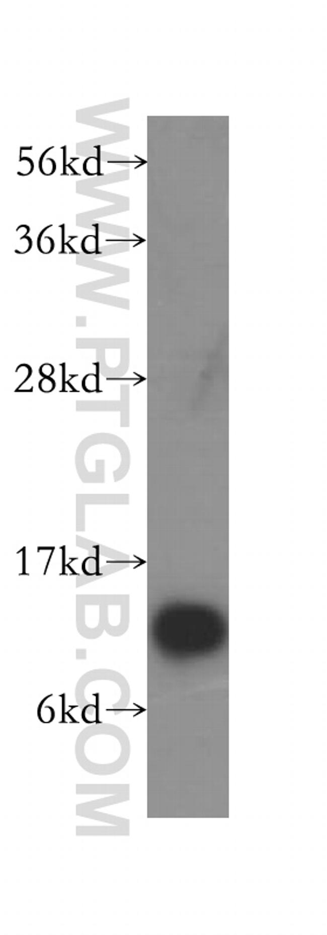 DYNLT1 Antibody in Western Blot (WB)