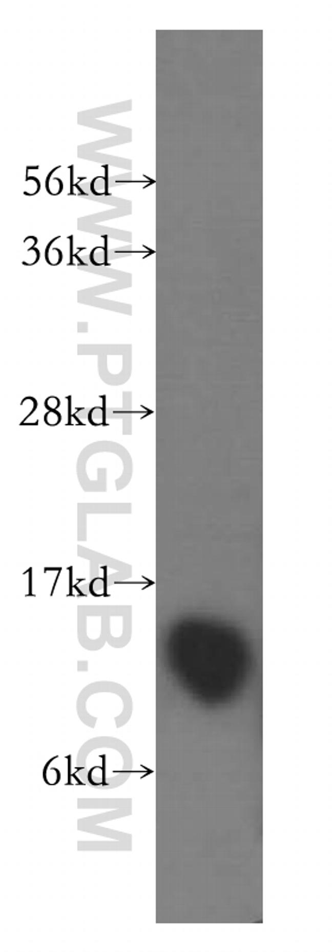 DYNLT1 Antibody in Western Blot (WB)