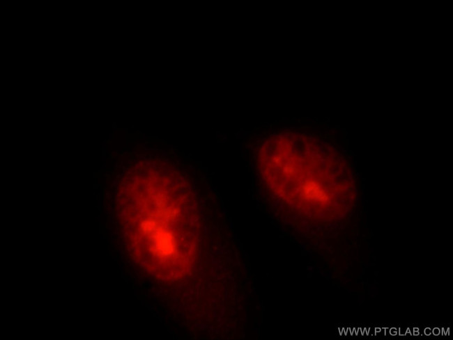 HELLS Antibody in Immunocytochemistry (ICC/IF)