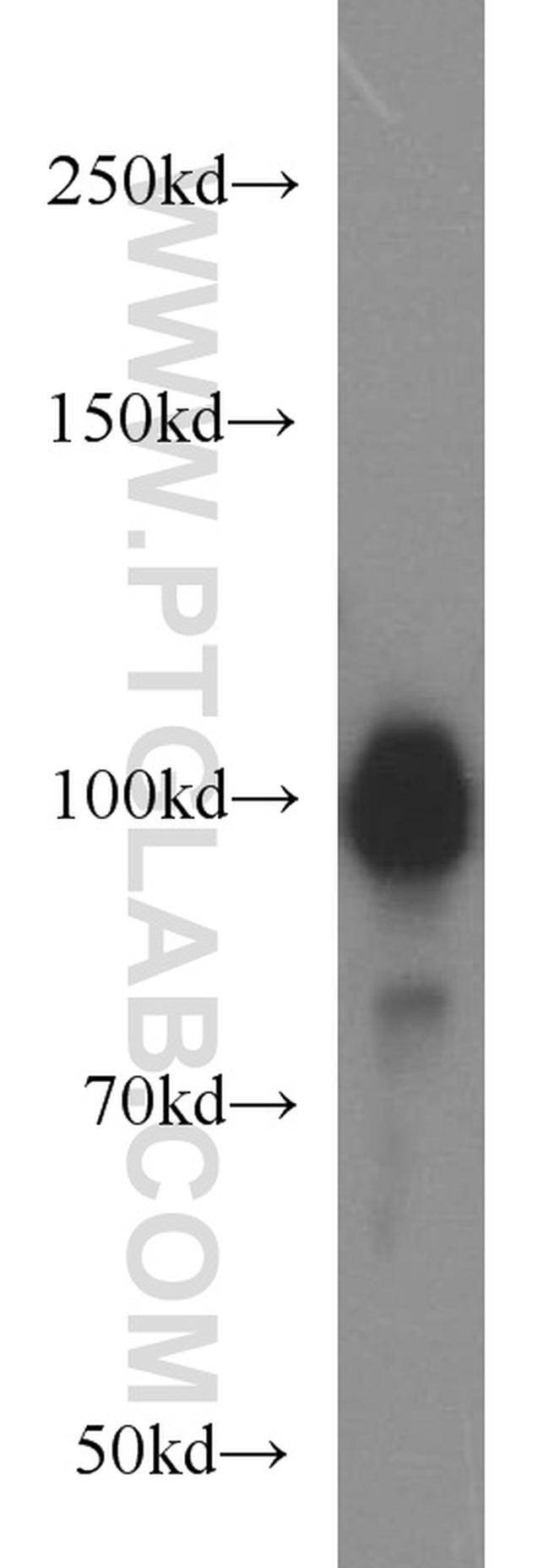 HELLS Antibody in Western Blot (WB)