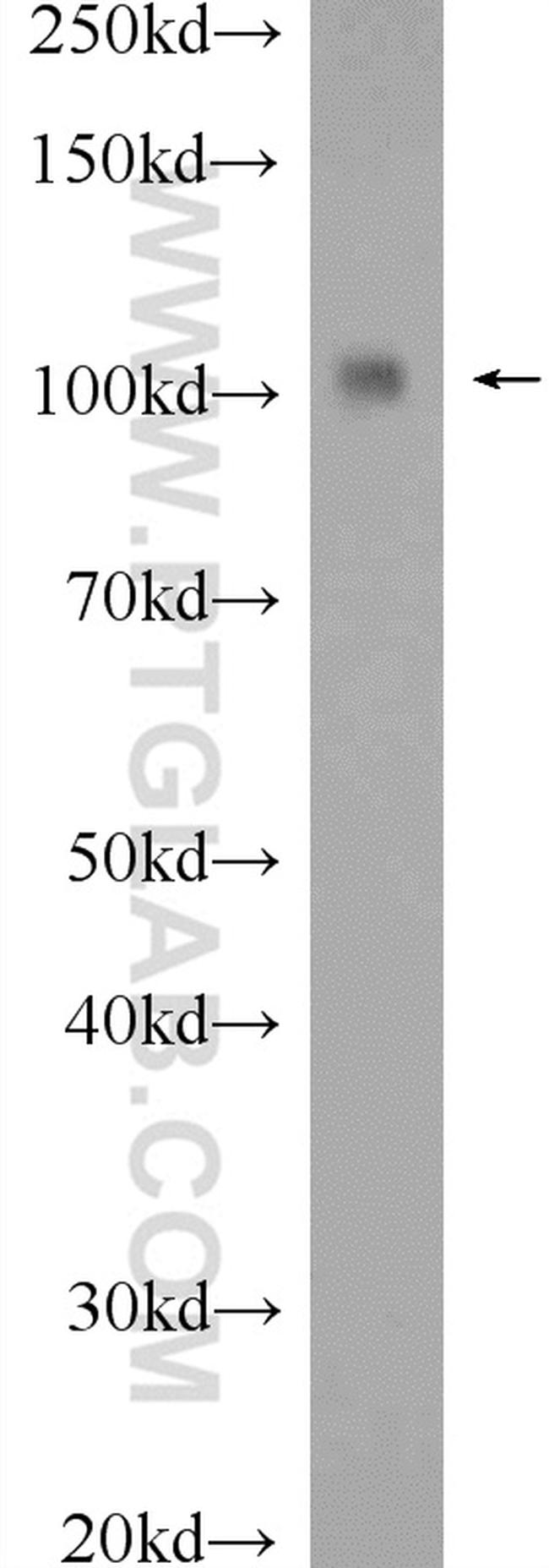 HELLS Antibody in Western Blot (WB)