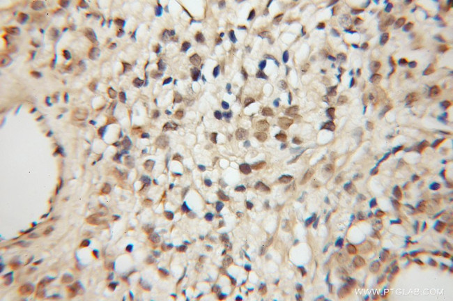 BRIT1 Antibody in Immunohistochemistry (Paraffin) (IHC (P))