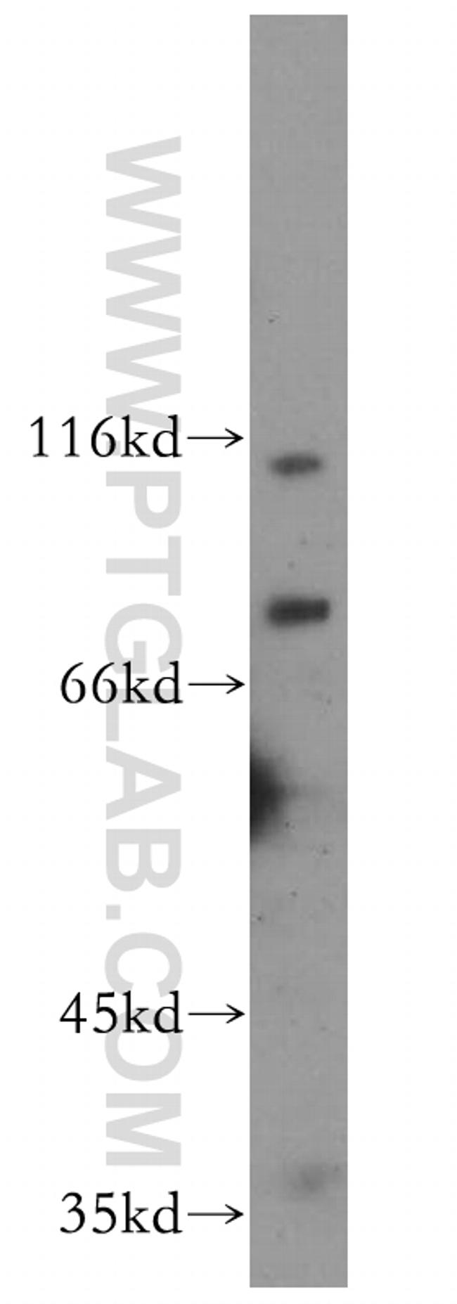 BRIT1 Antibody in Western Blot (WB)