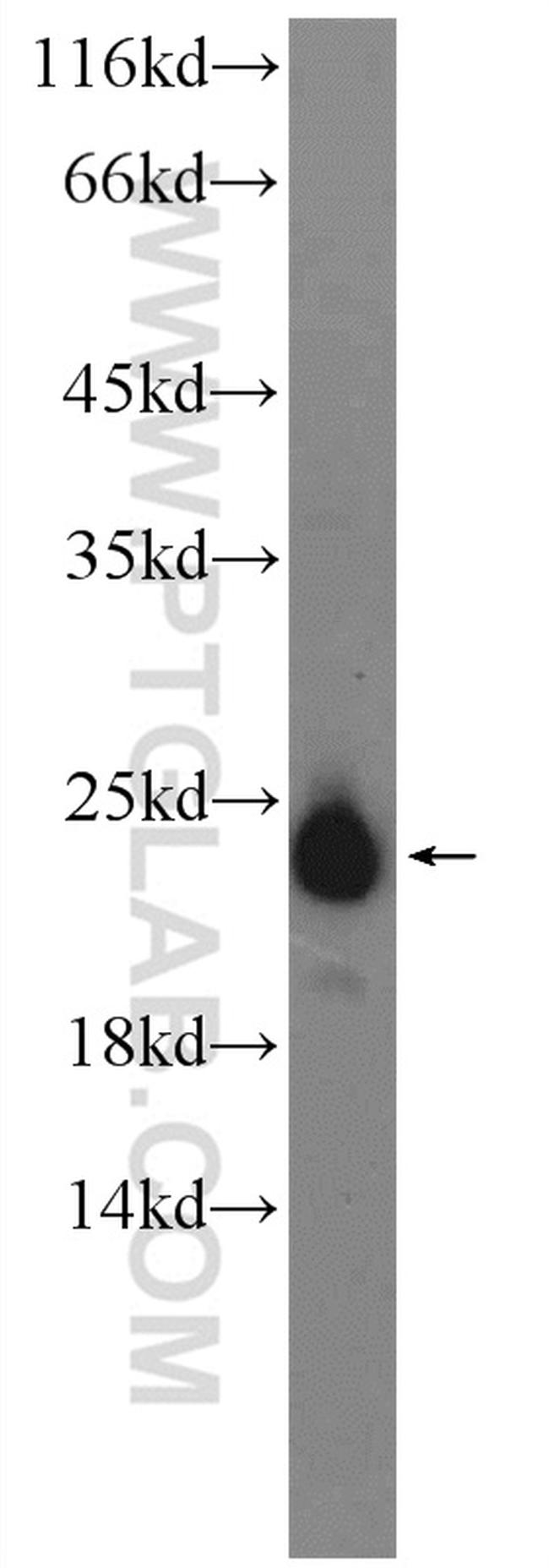 AGR3 Antibody in Western Blot (WB)