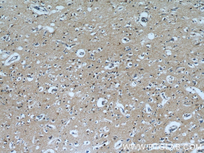 PPP1R2P9 Antibody in Immunohistochemistry (Paraffin) (IHC (P))