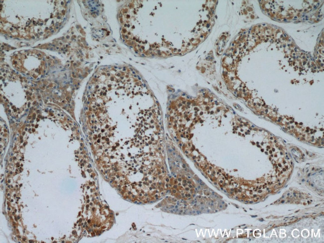 PPP1R2P9 Antibody in Immunohistochemistry (Paraffin) (IHC (P))