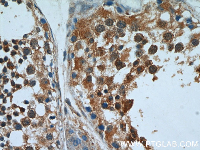 PPP1R2P9 Antibody in Immunohistochemistry (Paraffin) (IHC (P))