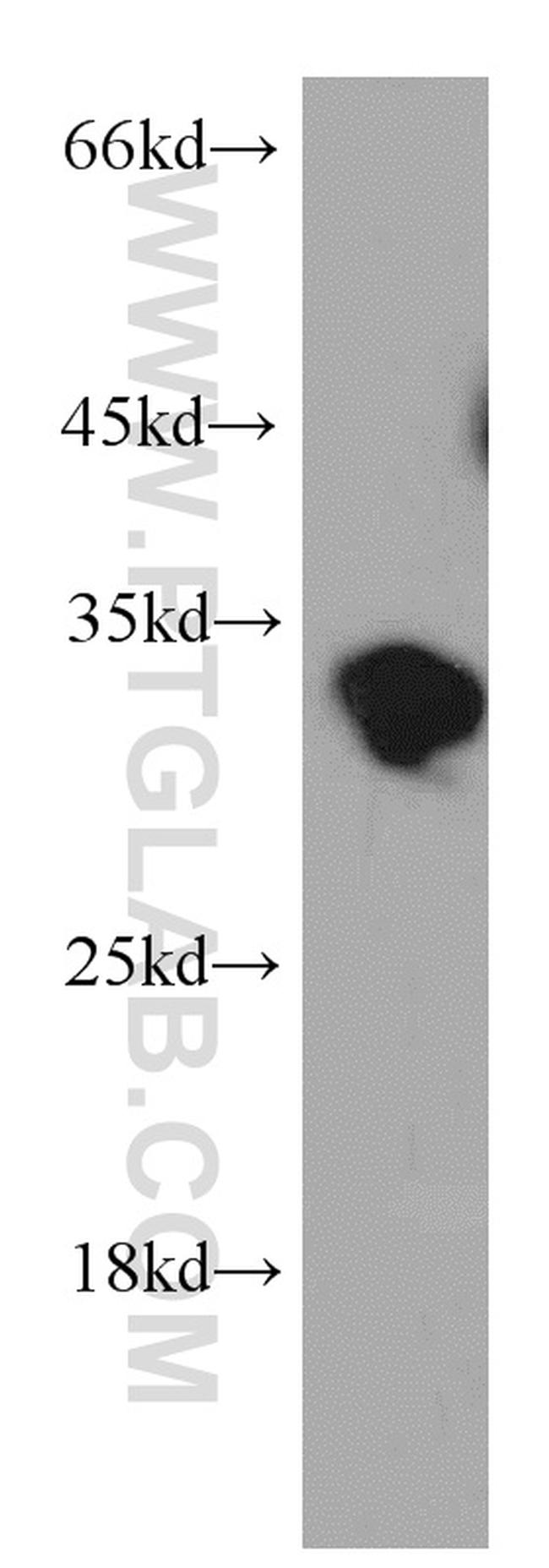 PPP1R2P9 Antibody in Western Blot (WB)