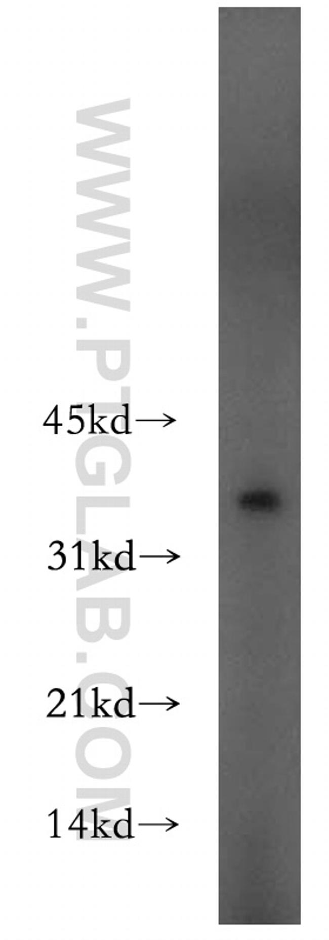 PPP1R2P9 Antibody in Western Blot (WB)