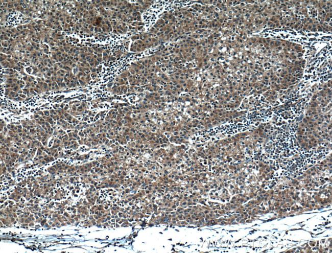 DNAJC2/MPP11 Antibody in Immunohistochemistry (Paraffin) (IHC (P))