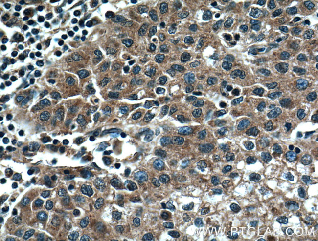 DNAJC2/MPP11 Antibody in Immunohistochemistry (Paraffin) (IHC (P))