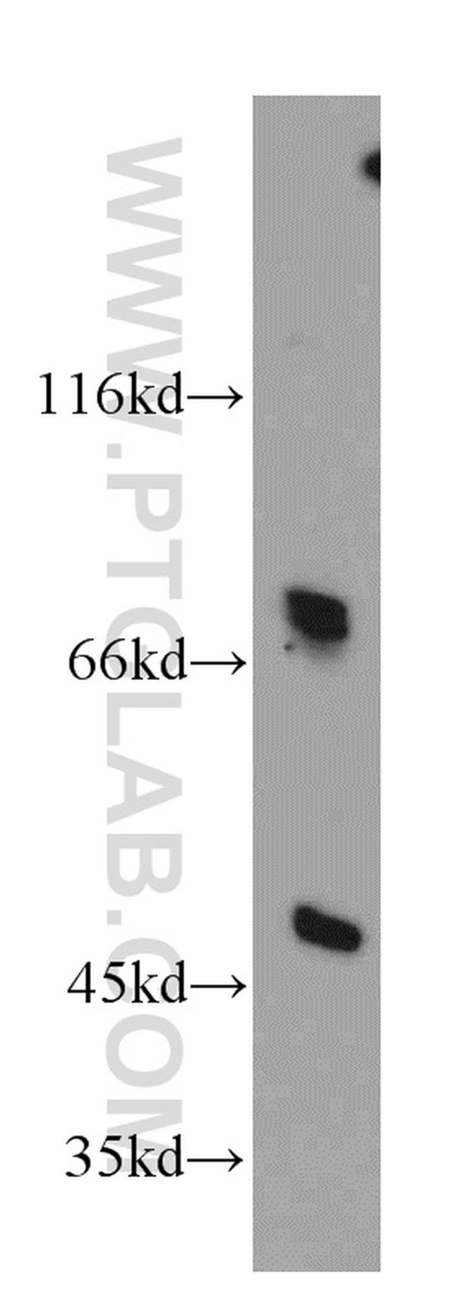 DNAJC2/MPP11 Antibody in Western Blot (WB)