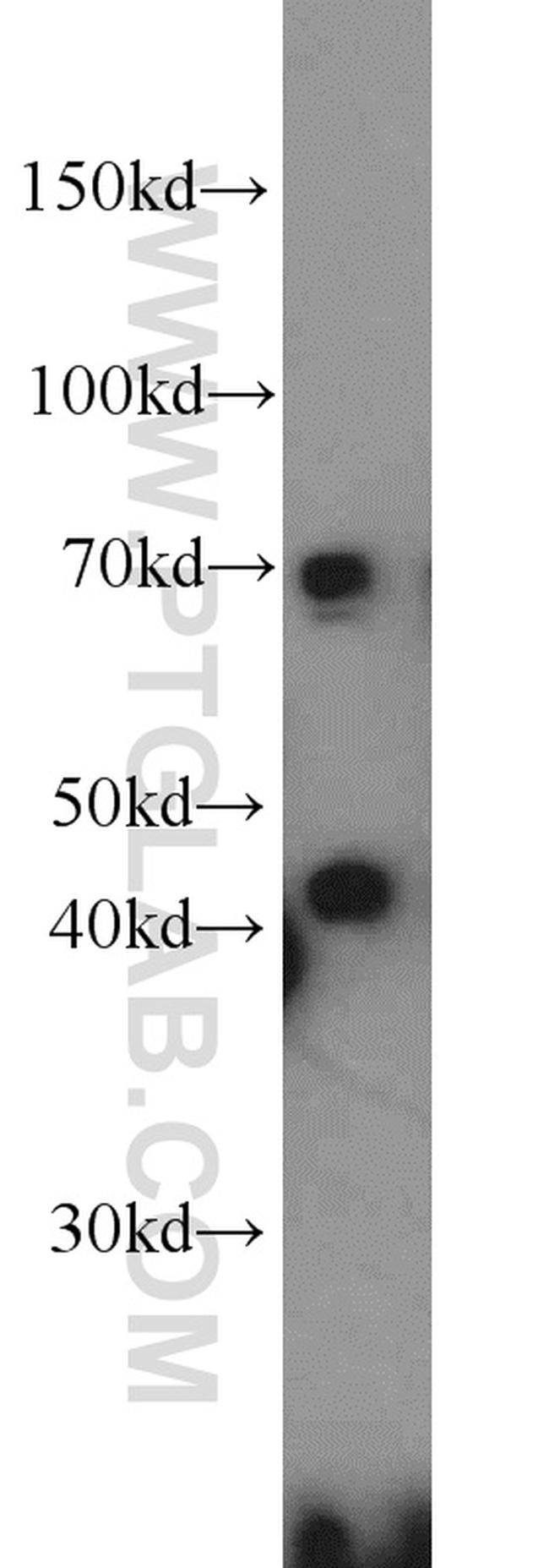 DNAJC2/MPP11 Antibody in Western Blot (WB)