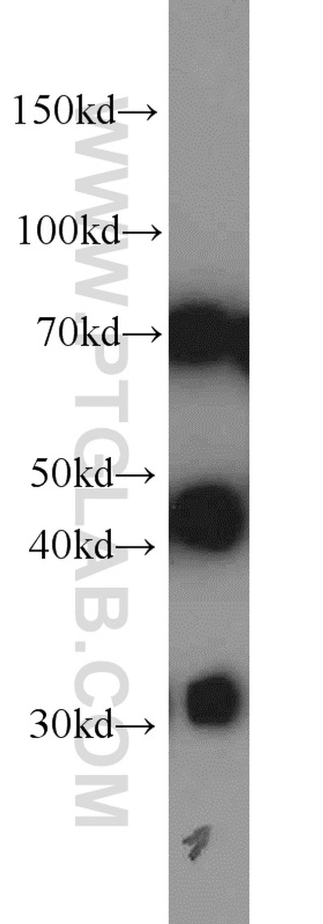 DNAJC2/MPP11 Antibody in Western Blot (WB)