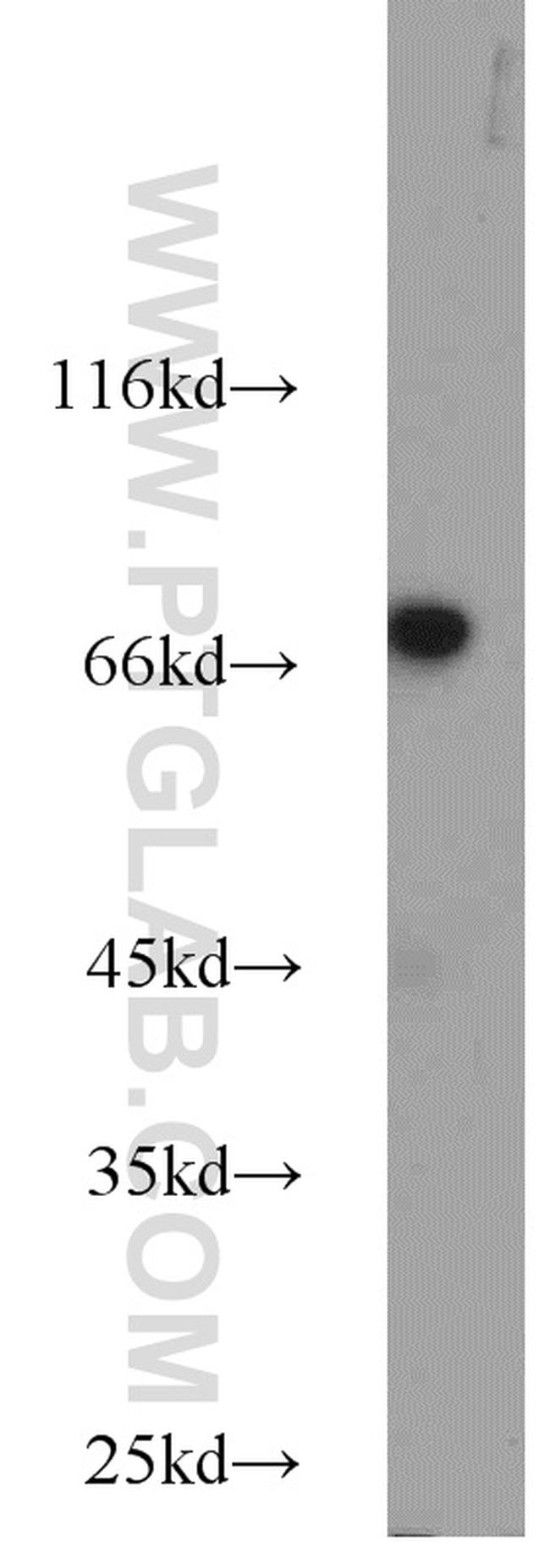 DNAJC2/MPP11 Antibody in Western Blot (WB)