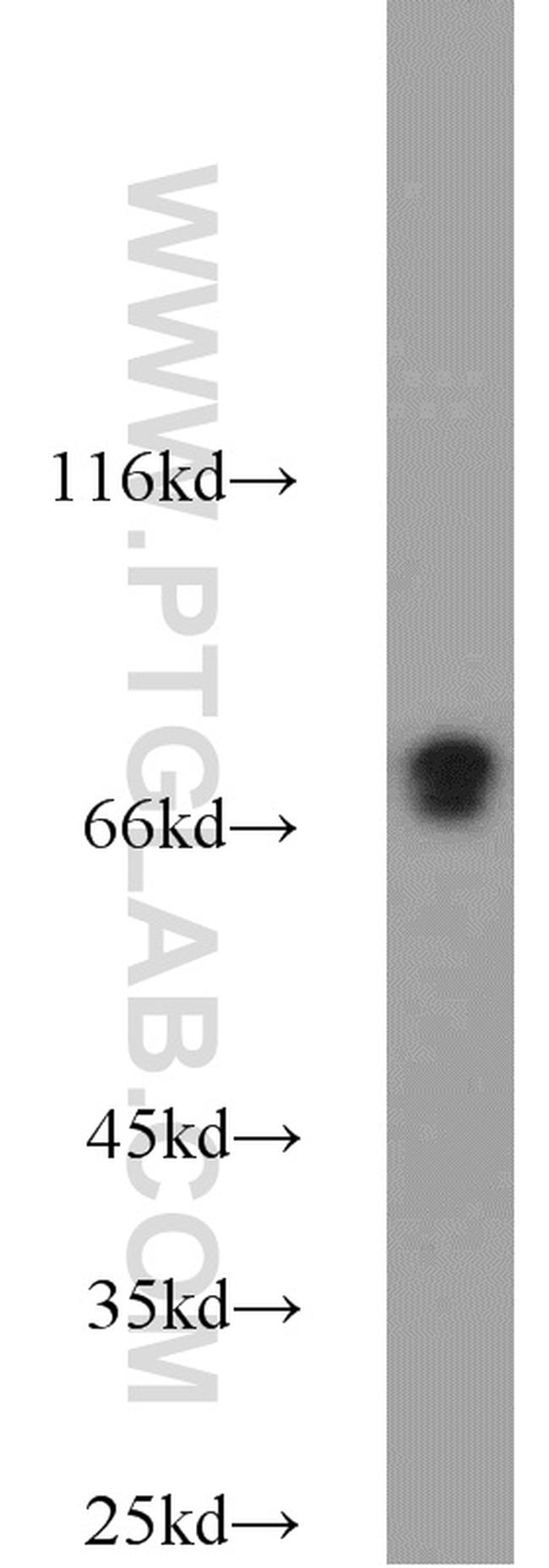 DNAJC2/MPP11 Antibody in Western Blot (WB)