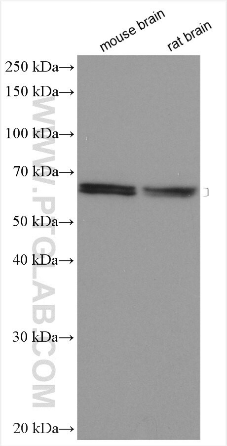 TIPIN Antibody in Western Blot (WB)