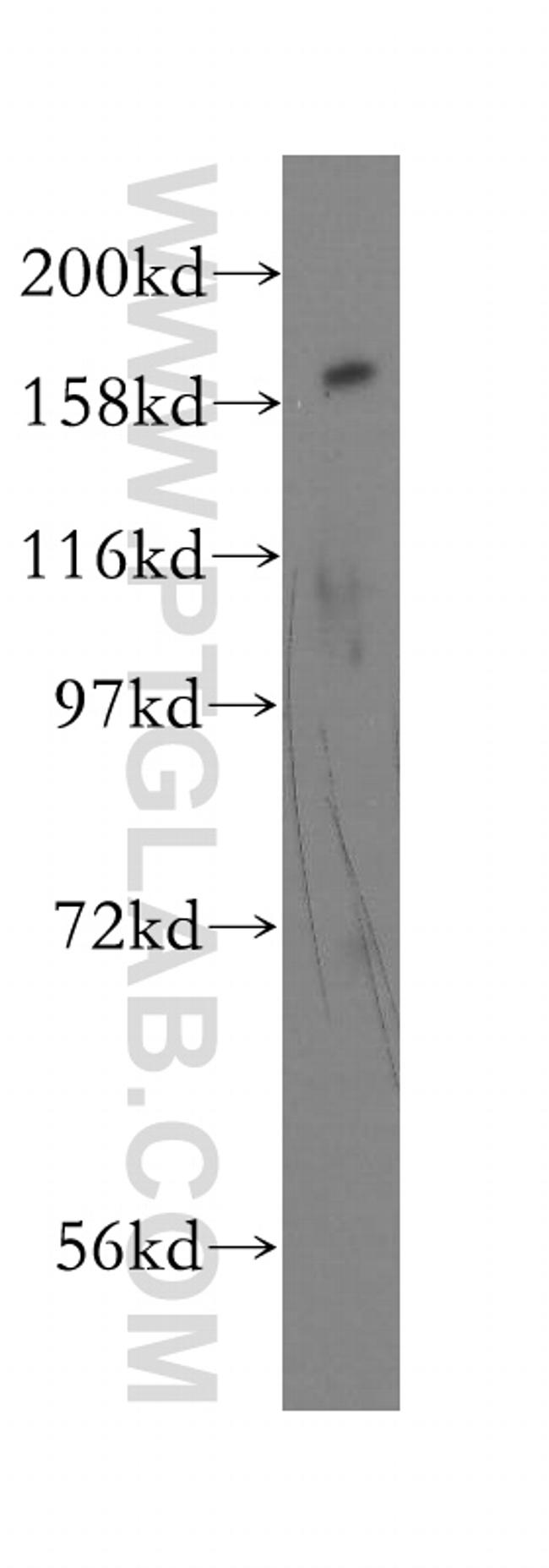 FANCA Antibody in Western Blot (WB)