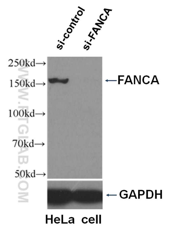 FANCA Antibody in Western Blot (WB)