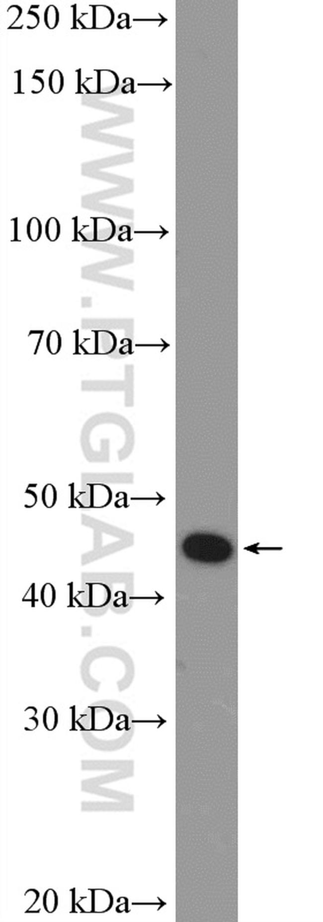 P2RY12 Antibody in Western Blot (WB)