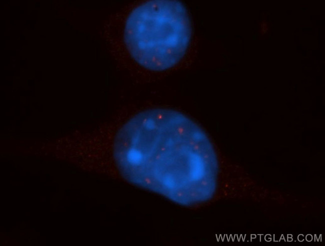 EXOSC8 Antibody in Immunocytochemistry (ICC/IF)