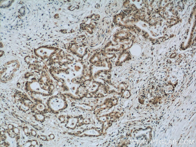 EXOSC8 Antibody in Immunohistochemistry (Paraffin) (IHC (P))