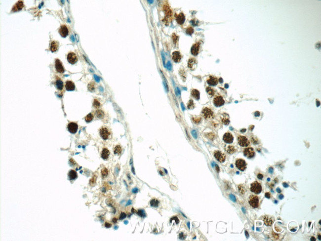 EXOSC8 Antibody in Immunohistochemistry (Paraffin) (IHC (P))