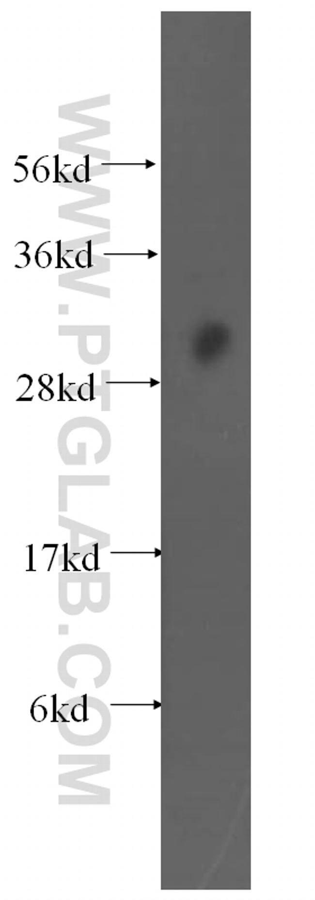 EXOSC8 Antibody in Western Blot (WB)