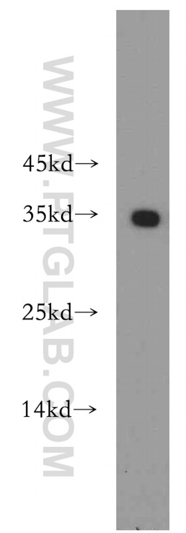 EXOSC8 Antibody in Western Blot (WB)