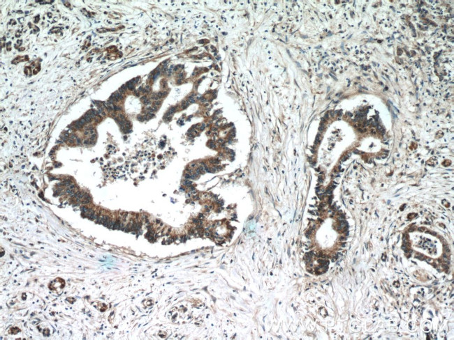 TMED2 Antibody in Immunohistochemistry (Paraffin) (IHC (P))