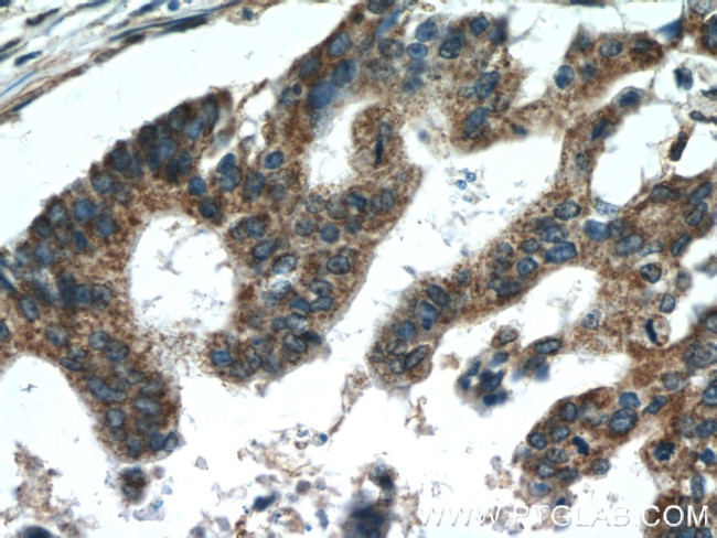 TMED2 Antibody in Immunohistochemistry (Paraffin) (IHC (P))