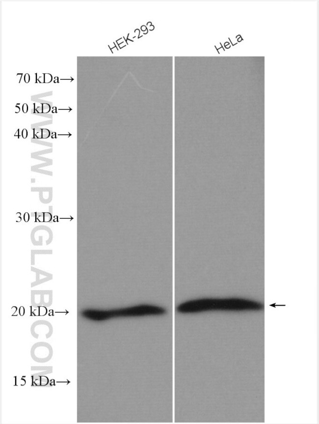 TMED2 Antibody in Western Blot (WB)