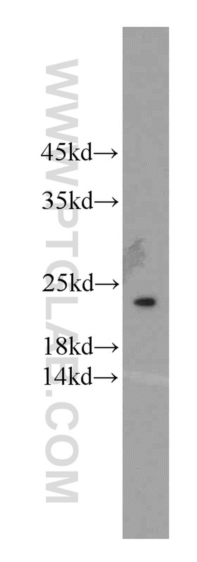 TMED2 Antibody in Western Blot (WB)