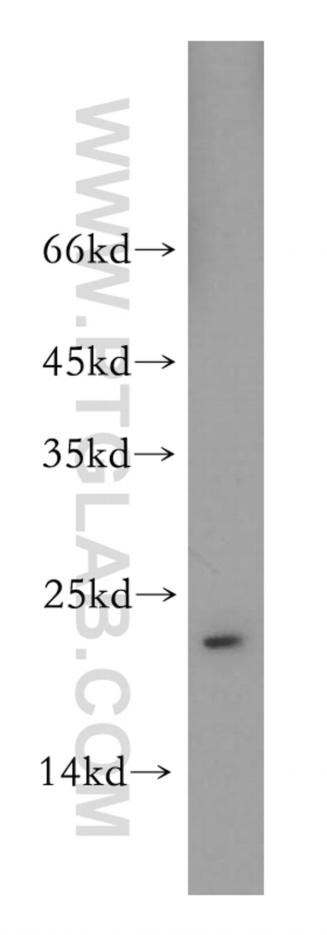 TMED2 Antibody in Western Blot (WB)