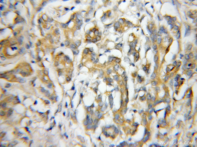 IL17RE Antibody in Immunohistochemistry (Paraffin) (IHC (P))