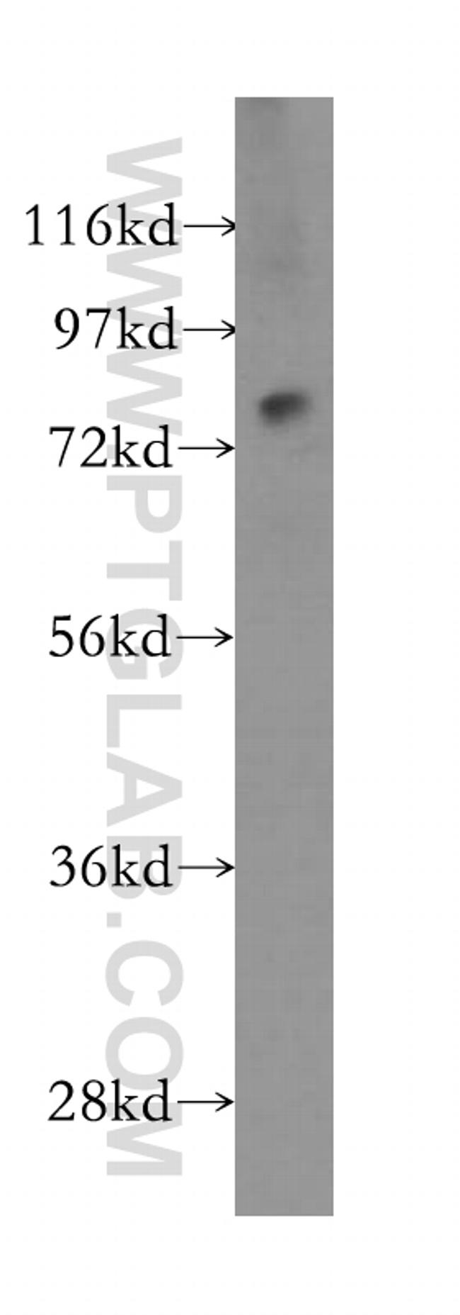 IL17RE Antibody in Western Blot (WB)