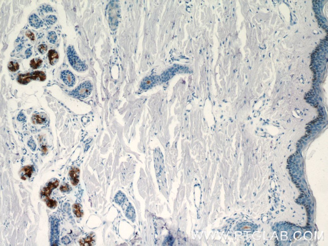 DCD Antibody in Immunohistochemistry (Paraffin) (IHC (P))