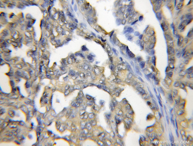 PRTFDC1 Antibody in Immunohistochemistry (Paraffin) (IHC (P))