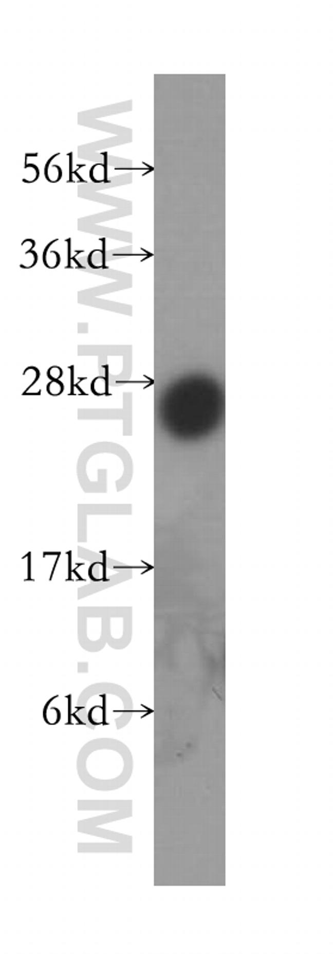 PRTFDC1 Antibody in Western Blot (WB)