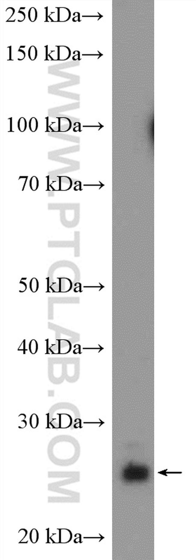 PRTFDC1 Antibody in Western Blot (WB)