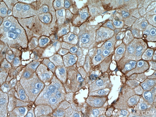 CD147 Antibody in Immunohistochemistry (Paraffin) (IHC (P))