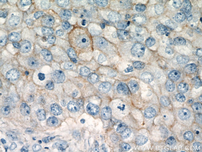 CD147 Antibody in Immunohistochemistry (Paraffin) (IHC (P))