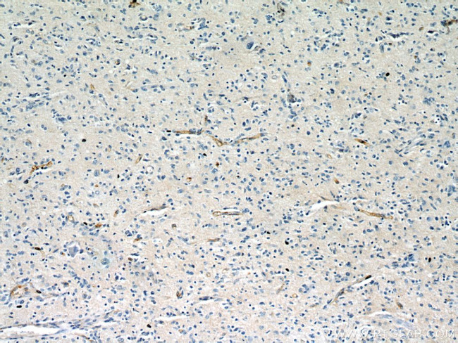 CD147 Antibody in Immunohistochemistry (Paraffin) (IHC (P))