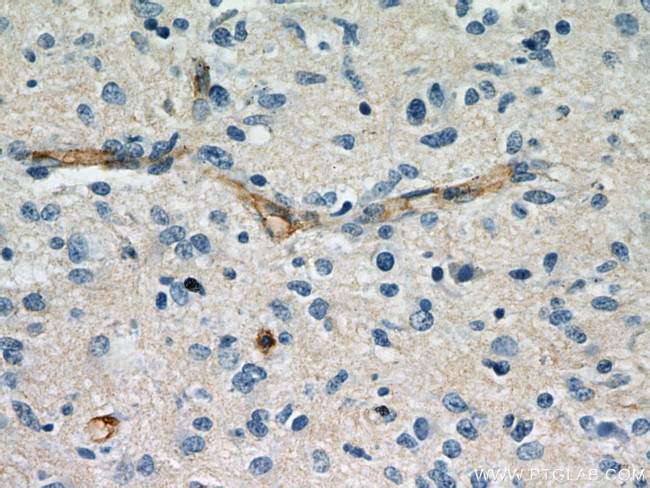 CD147 Antibody in Immunohistochemistry (Paraffin) (IHC (P))