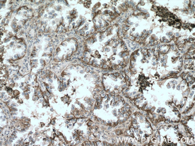 CD147 Antibody in Immunohistochemistry (Paraffin) (IHC (P))