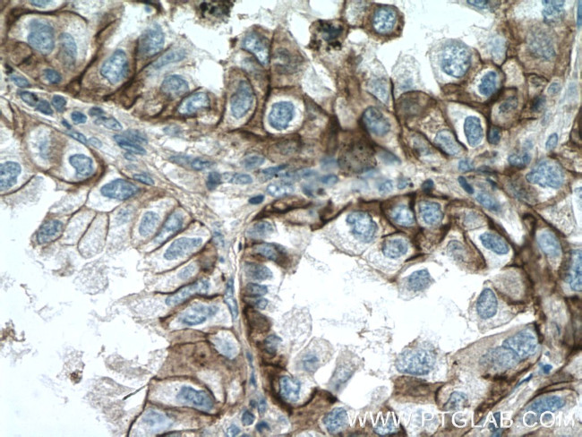 CD147 Antibody in Immunohistochemistry (Paraffin) (IHC (P))