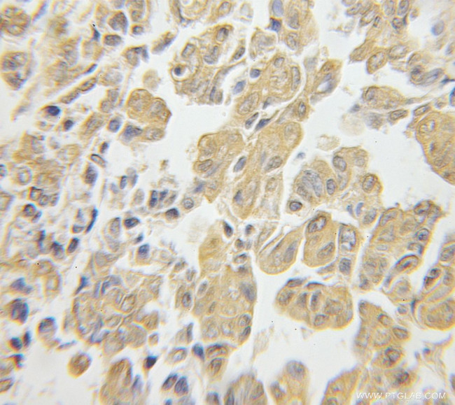 RPS3 Antibody in Immunohistochemistry (Paraffin) (IHC (P))