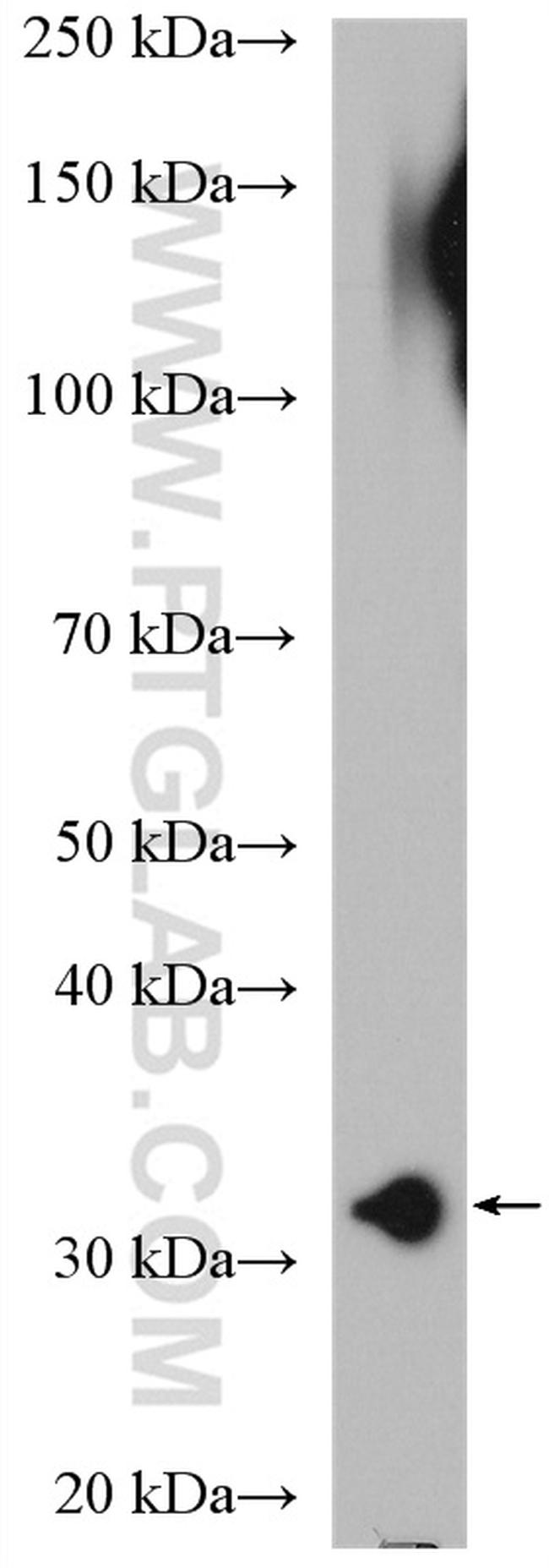 RPS3 Antibody in Western Blot (WB)